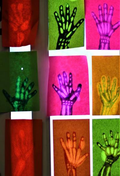 Hand-made human hand X-rays, a project coordinated by art teacher Cynthia Gedraits. Photo by: Nadya Korytnikova